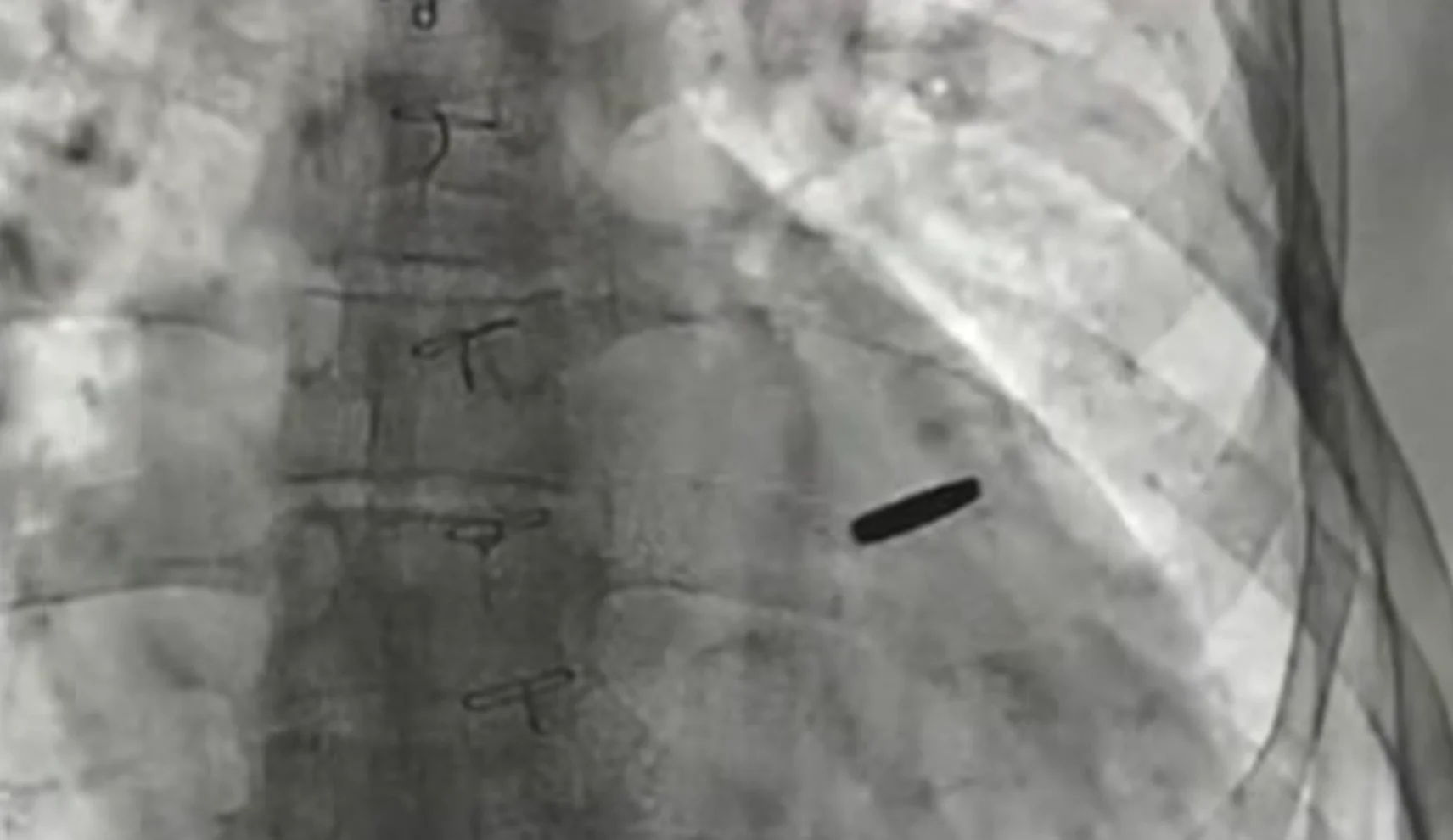 Bullet in Serhiy’s heart Screenshot