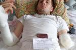 <b>There are no two legs and arms: a serviceman from Cherkasy region was seriously wounded in the war</b>